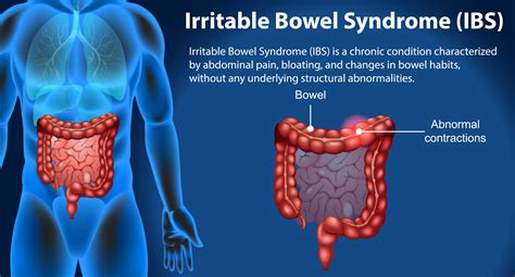 ICD-10 Irritable Bowel Syndrome: Decoding the Gut-Brain Connection