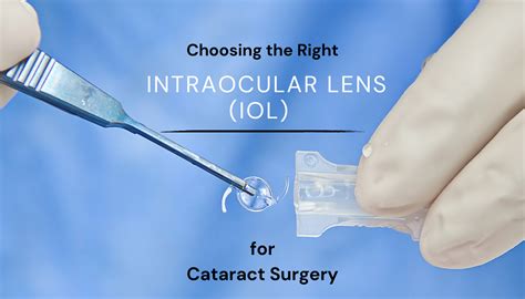 IOL Surgery Intraocular Lenses in Cataract and Refractive Surgery Kindle Editon