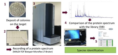 Identification of Microorganisms by Mass Spectrometry Reader