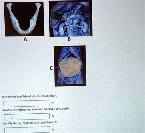 Identify the 5 Highlighted Structures in These Images