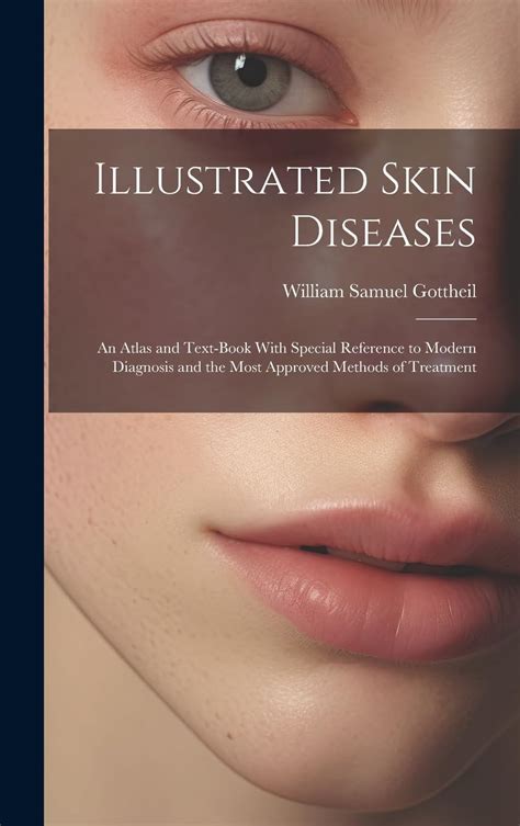 Illustrated Skin Diseases; An Atlas and Text-Book with Special Reference to Modern Diagnosis and the Doc