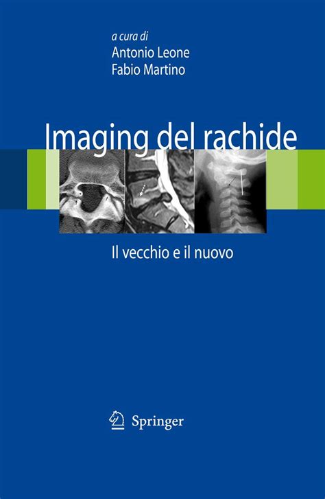 Imaging del rachide Il vecchio e il nuovo 1st Edition Kindle Editon