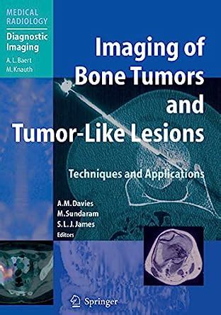 Imaging of Bone Tumors and Tumor-Like Lesions Techniques and Applications Reader