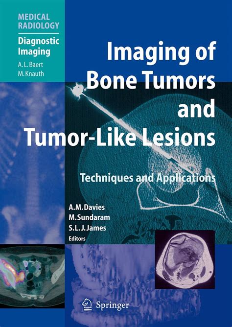 Imaging of Bone Tumors and Tumor-Like Lesions Techniques and Applications Reader