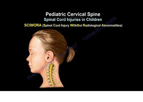 Imaging of the Cervical Spine in Children 2nd Printing Reader