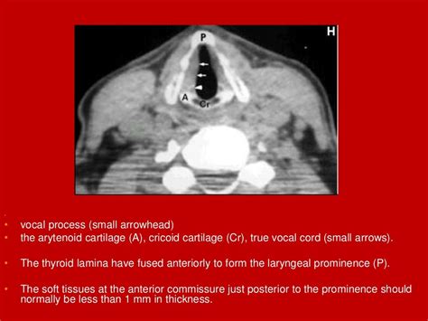 Imaging of the Larynx Reader