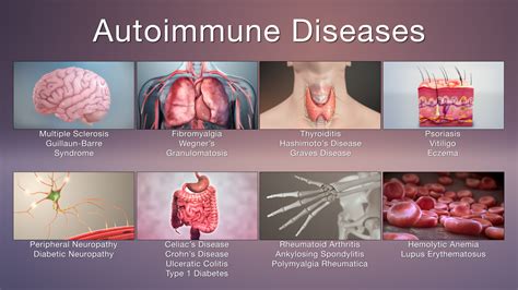 Immune system disturbances: