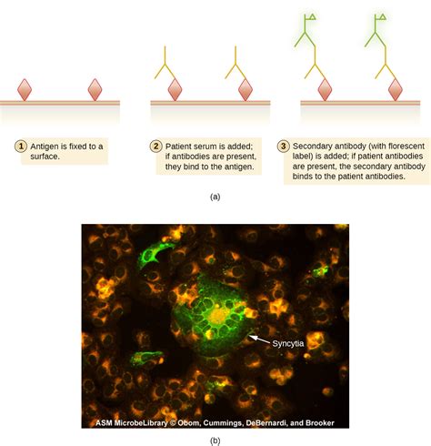 Immunofluorescence Antigen Detection Techniques in Diagnostic Microbiology Doc