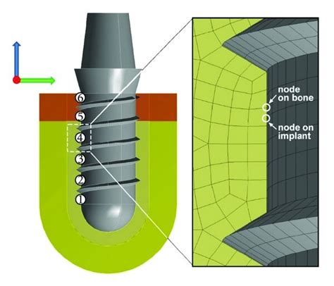 Implant Bone Interface Reader