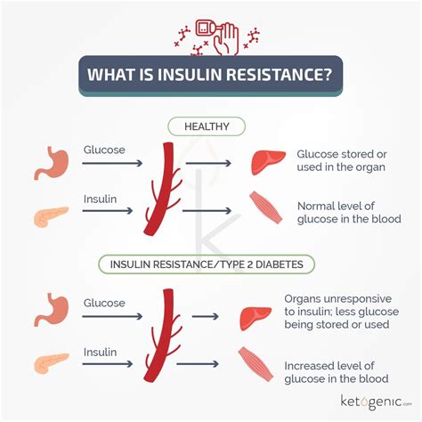 Improve insulin sensitivity: