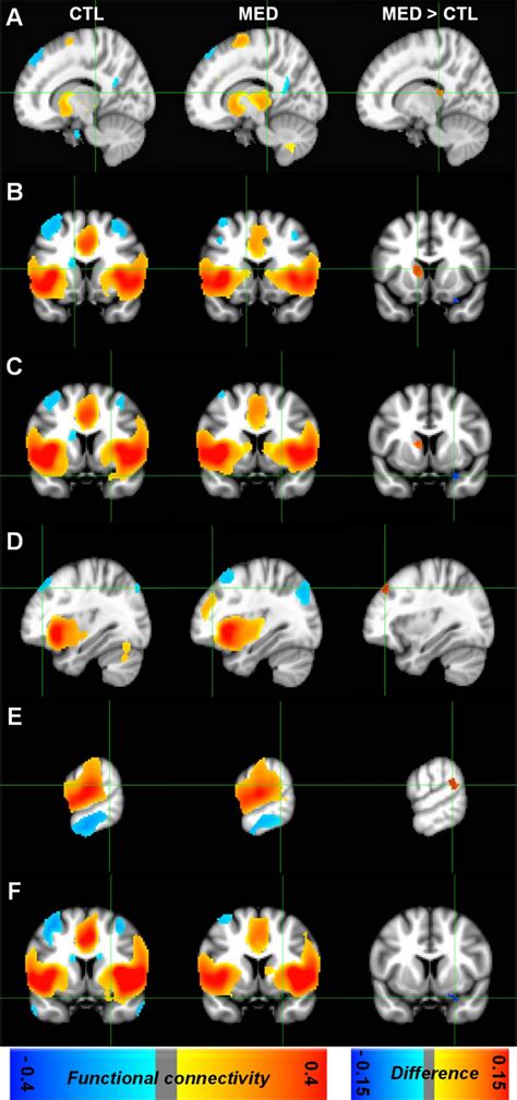 Improved brain connectivity: