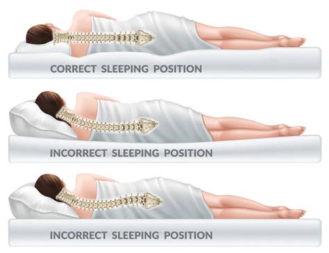 Improved spinal alignment: