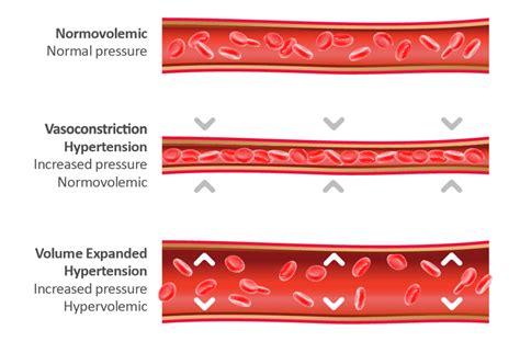 Increased blood volume: