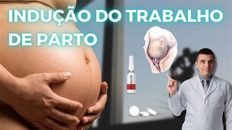 Indução do Parto: Um Guia Abrangente para Alcançar o Nascimento Tratado