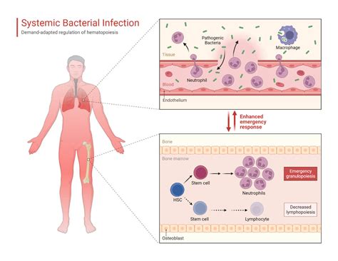 Infection: