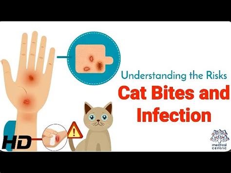 Infections from Cat Bites: A Comprehensive Guide to Prevention, Treatment, and Management