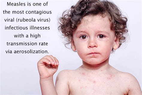 Infectious Diseases of Children Doc