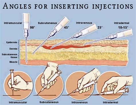 Injection 15 Kindle Editon