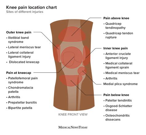 Injuries of Knee Doc