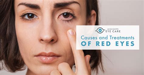 Inner Corner of Eye Red: Causes and Treatments