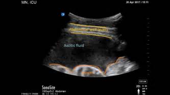 Innovations in Abdominal Ultrasound Reader