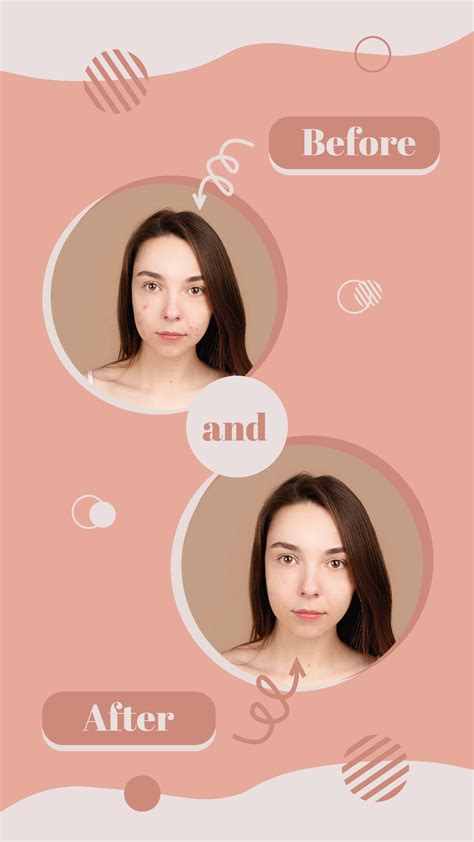 Instagram Before And After Template