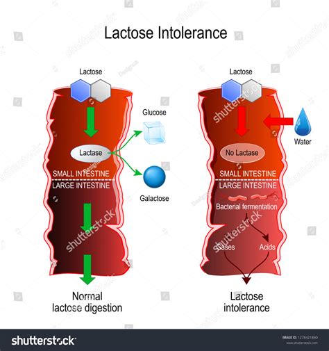 Instant Lactose Digestion: