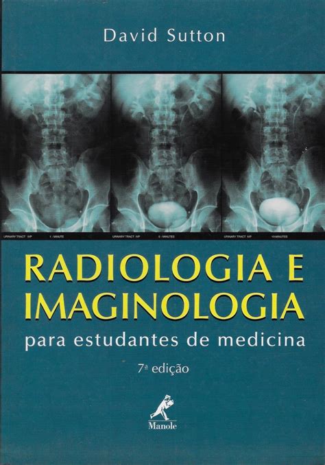 Instituto de Radiologia: Guia Completo para Diagnóstico por Imagem