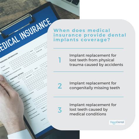 Insurance for Dental Implants: 4 Key Numbers You Need to Know