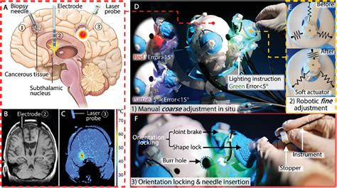 Interactive Image - Guided Neurosurgery Epub