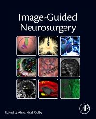 Interactive Image-Guided Neurosurgery 1st Edition Doc