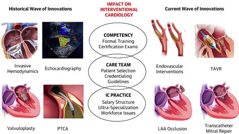 Interventional Cardiology Future Directions PDF