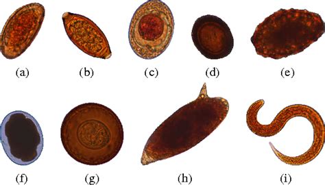 Intestinal Parasite Human Parasite Identification Chart
