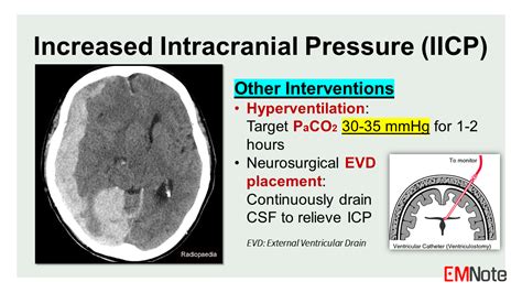 Intracranial pressure (ICP):