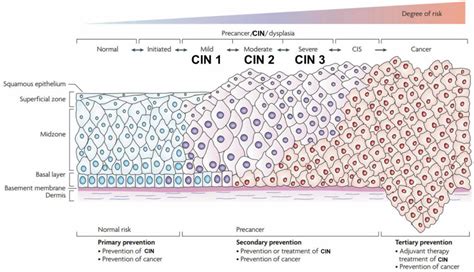 Intraepithelial Neoplasia Doc