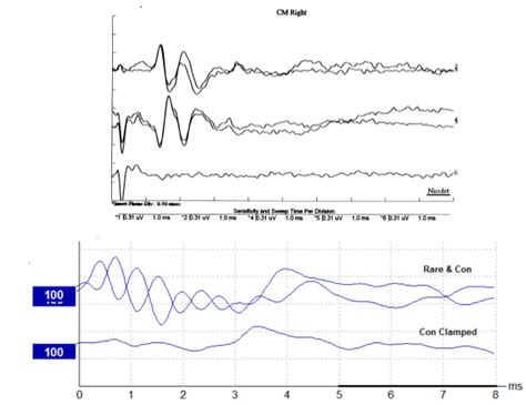 Introduction: The Dawn of a Microphonic Revolution