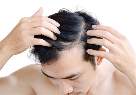 Introduction: The Plight of Thinning Hair for Men