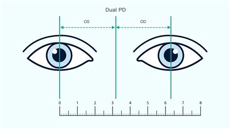 Introduction: The Significance of Precise PD Measurements