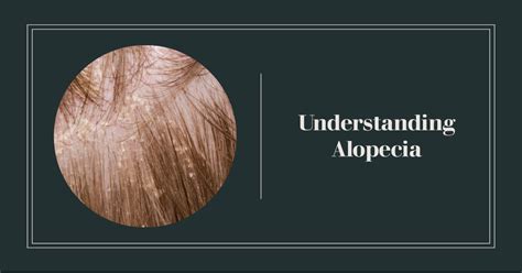 Introduction: Understanding Alopecia