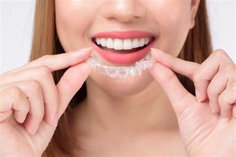 Invisalign & Insurance: 10,000+ Facts Unveiled