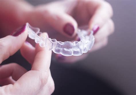 Invisalign Fence Collars: A Comprehensive Guide