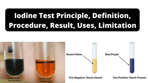 Iodine Stains Starch What Color: A Comprehensive Guide