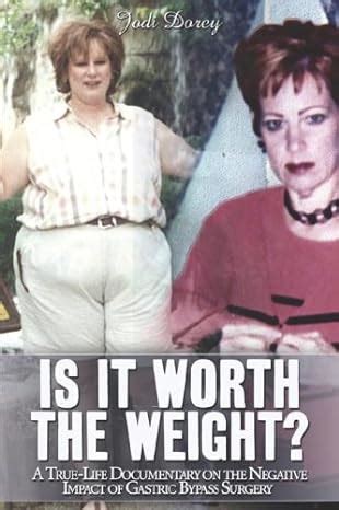 Is It Worth the Weight? A True-Life Documentary on the Negative Impact of Gastric Bypass Surgery Kindle Editon