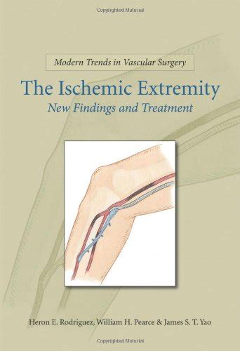 Ischemic Extremities, New Findings & Doc