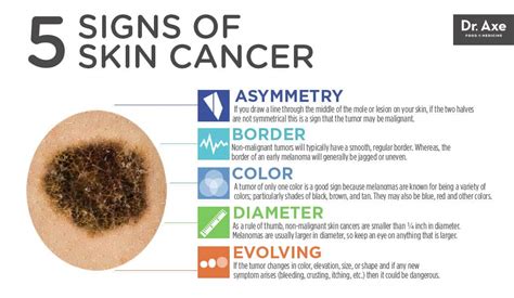 Itchy Skin Cancer: Know the Signs and Seek Treatment