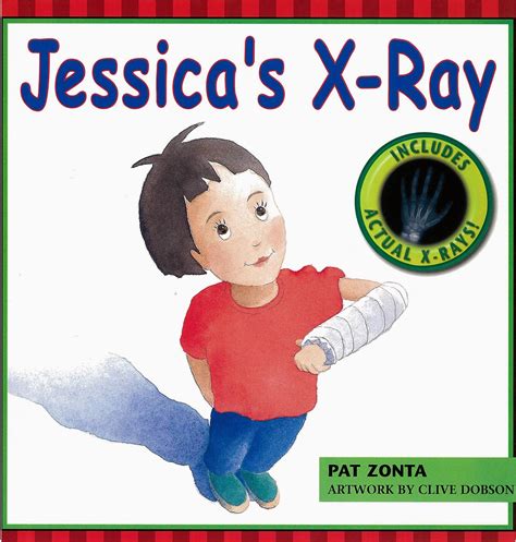 Jessica's X-Ray Epub