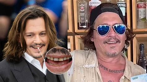 Johnny Depp's Teeth 2024: A Timeline of Transformation