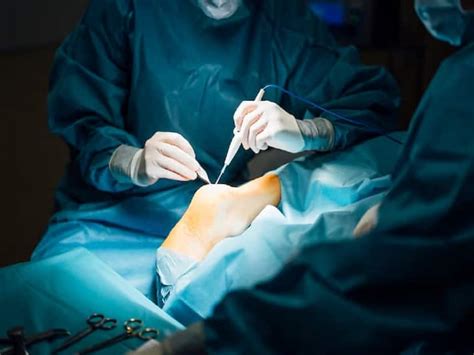 Joint Replacement Surgery: