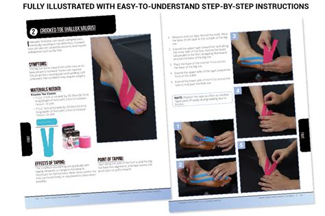 KINESIO TAPING PERFECT MANUAL Ebook PDF