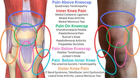 Knee Pain Due to Muscle Weakness: Here's the Ultimate Guide for 2025